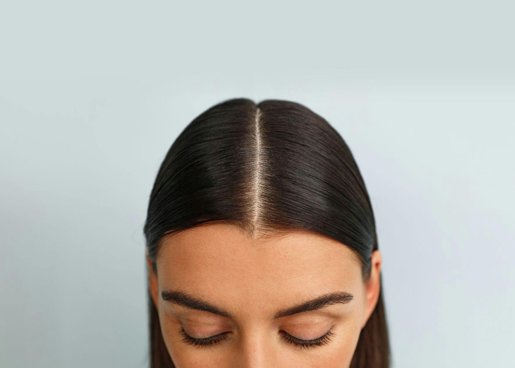 Photo of model with healthy scalp